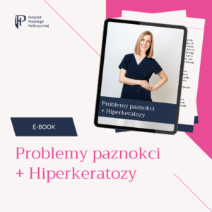 E-book Problemy paznokci + Hiperkeratozy