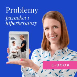 E-book Problemy paznokci + Hiperkeratozy